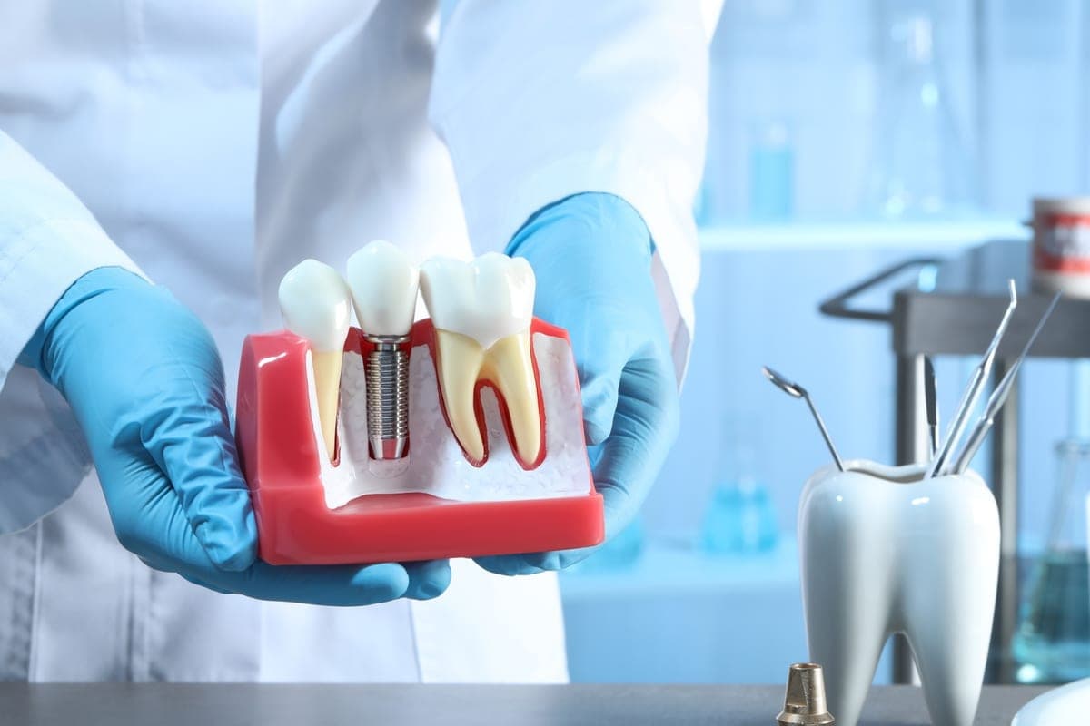 Smiling older adult considering dental implants in Clearwater versus dentures