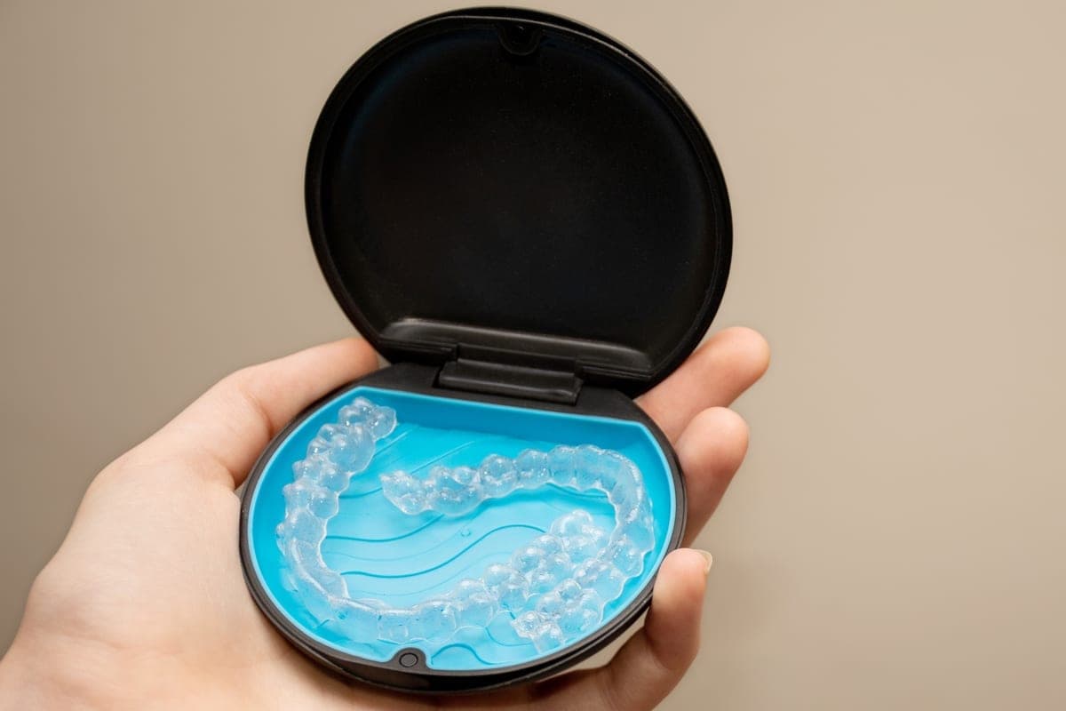 Patient placing a clear aligner during Invisalign treatment in Clearwater