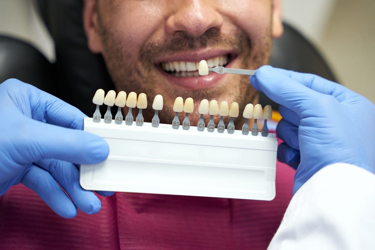 Porcelain veneers in Clearwater: patient reviewing veneer candidacy