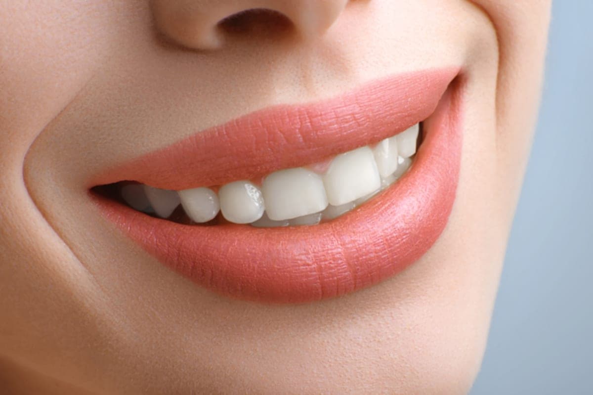 Woman smiling after professional teeth whitening in Clearwater