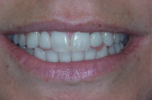 Cosmetic transformation — after treatment