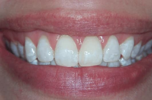 Cosmetic transformation — after treatment