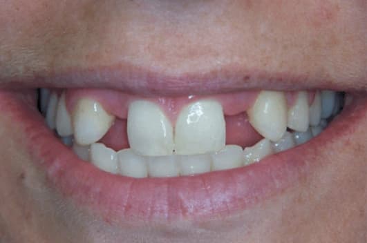 Cosmetic transformation — before treatment