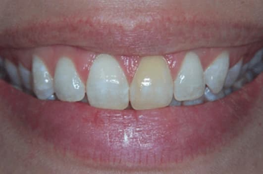 Cosmetic transformation — before treatment